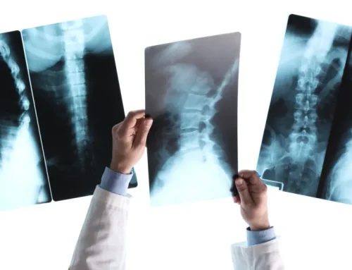 How Do Pre-Existing Conditions Affect Your Personal Injury Claim in California?